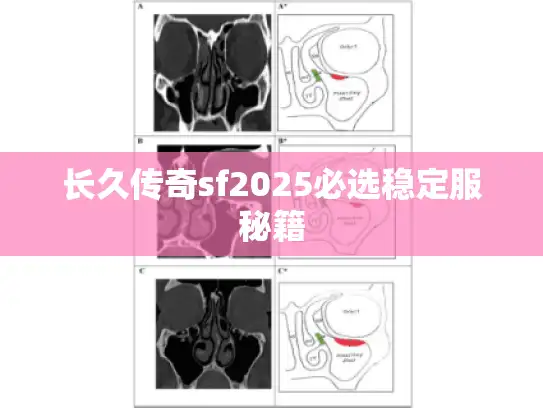 长久传奇sf2025必选稳定服秘籍 长久传奇sf2025必选稳定服秘籍