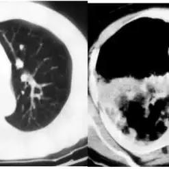 《空洞骑士》丝之歌MOD攻略：怪物掉落念珠+掉钱MOD下载，轻松升级！