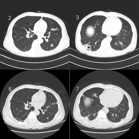 《空洞骑士》装备升级攻略：深度解析丝之歌系统革新亮点