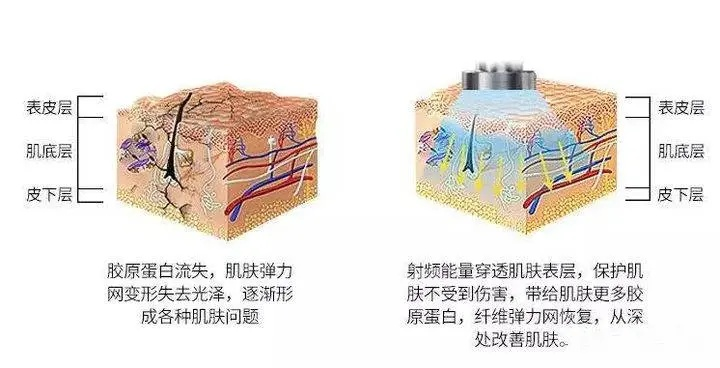 全新治疗吸收纹理亮相，团队框架纹理全面升级革新