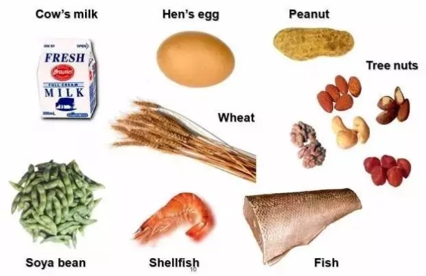 惊!上百种食物过敏,她是如何生存的? 惊!上百种食物过敏,她是如何生存的?