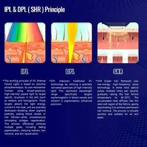 IPL6类型强脉冲光到底强在哪？硬核拆解与玩家实测报告