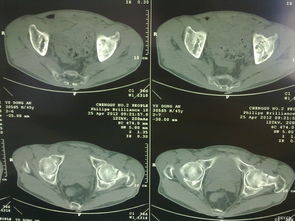 生化3RE骨折新史低，折后价格堪比白菜！